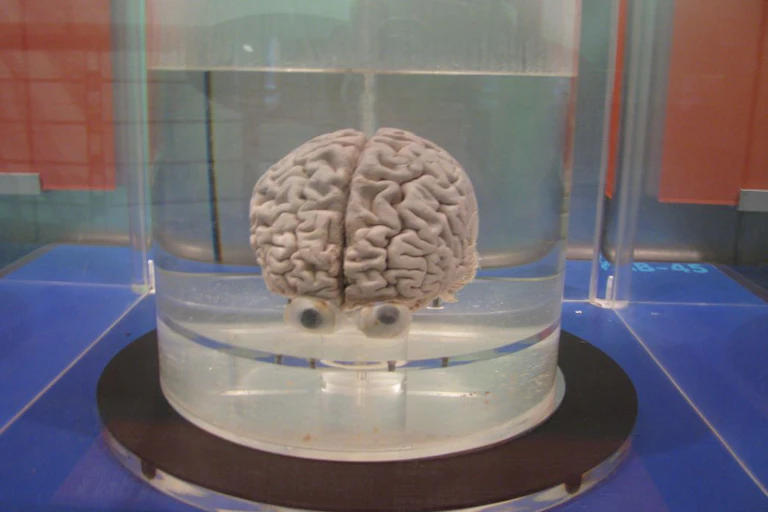 Super Intellect Explainer: what is superintelligence?