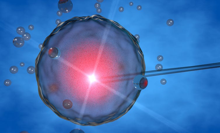 Artificial insemination, in vitro fertilisation IVF of human egg cell.