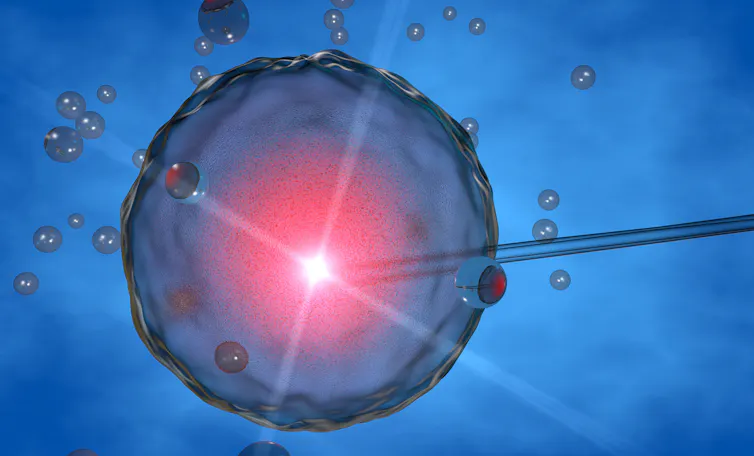 Inseminación artificial, fecundación in vitro FIV de óvulo humano.