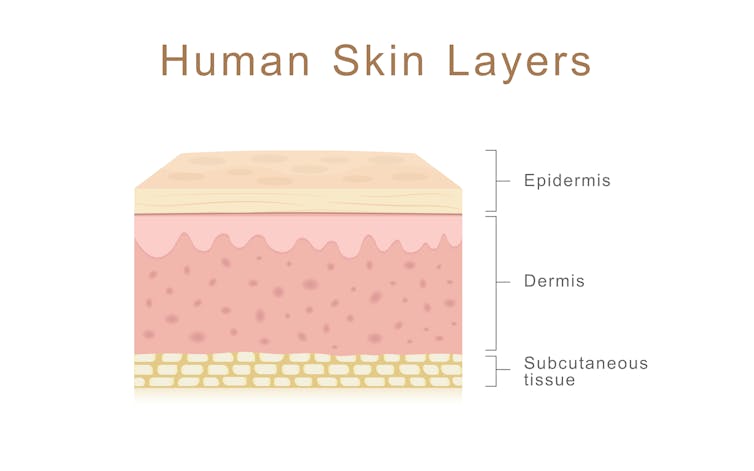Diagram showing human skin layers
