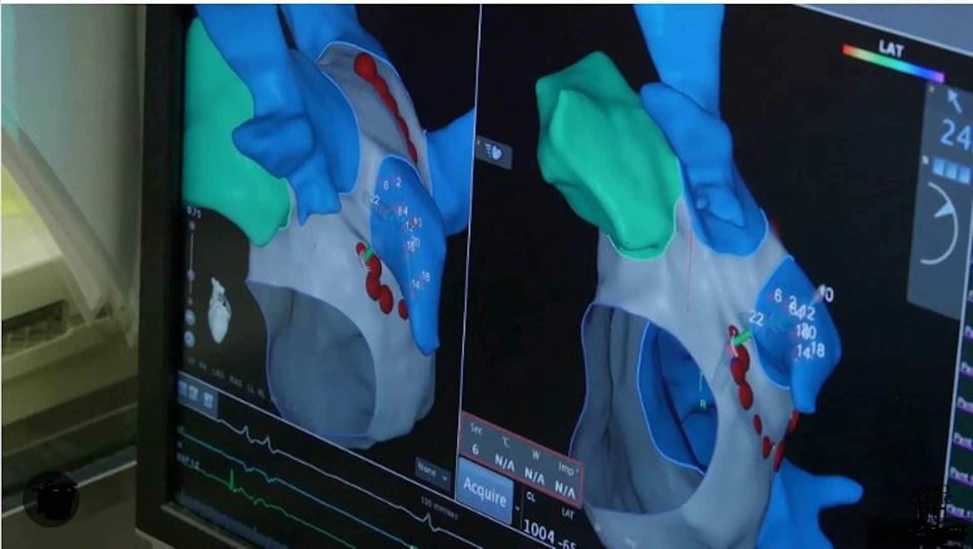 Yuk Mengenal Apa Saja Contoh dari Deep Learning dalam AI