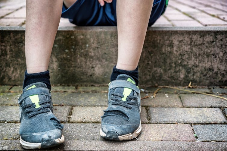 A child with broken shoes sits on a concrete step.