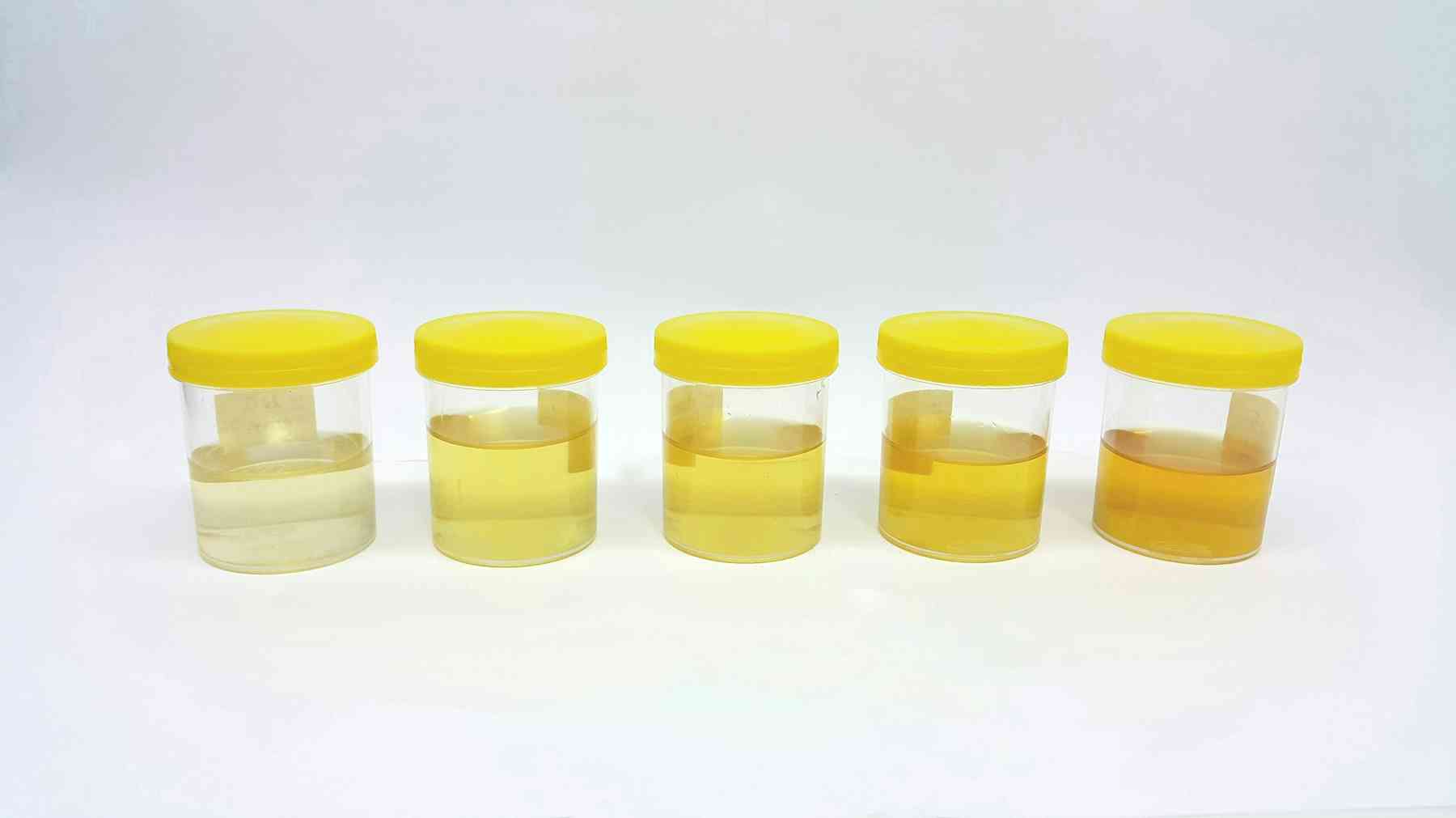 A brief history of pregnancy tests – from toads and rabbits to rosewater