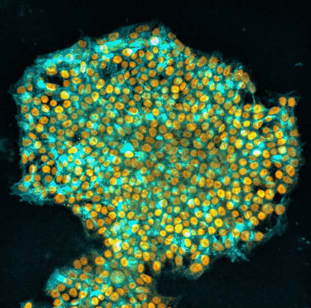 A blob of bright yellow and green cells.
