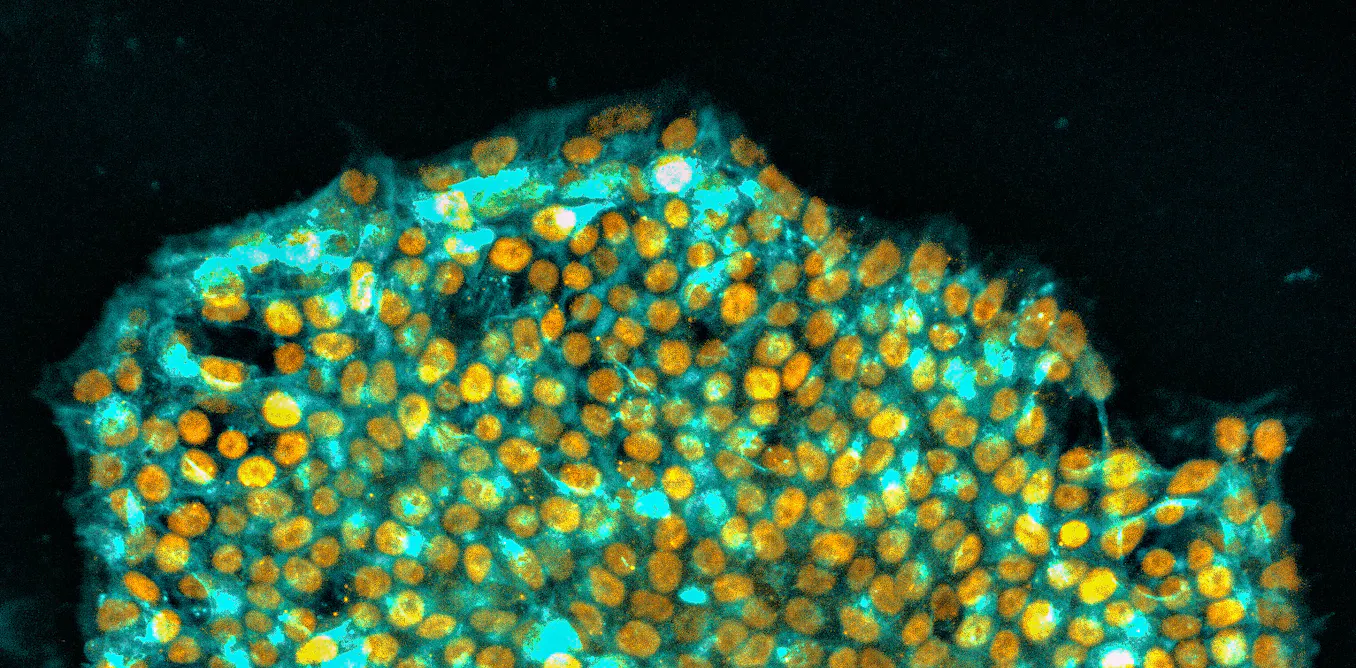 Memory Wipe Module A ‘memory wipe’ for stem cells may be the key to better therapies