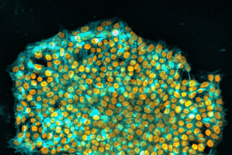 A blob of bright yellow and green cells.