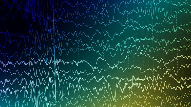 Brain waves on electroencephalogram EEG.