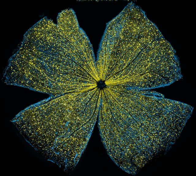 Microscopy image of mouse retina that resembles the gossamer wings of a butterfly