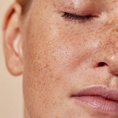 Can I put cortisone on my face? The right advice on creams to fix