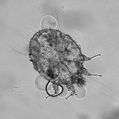 A microscope image showing a tiny translucent bug.