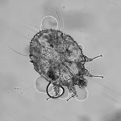 A microscope image showing a tiny translucent bug.
