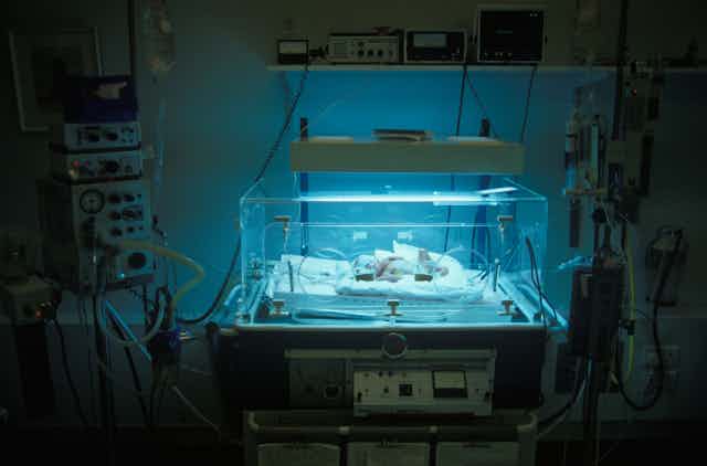 Baby in a neonatal unit