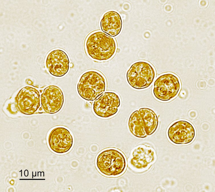 Symbiont algae from a reef coral viewed under a microscope.