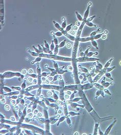 Estructuras productoras de esporas del hongo _Trichoderma harzianum_.