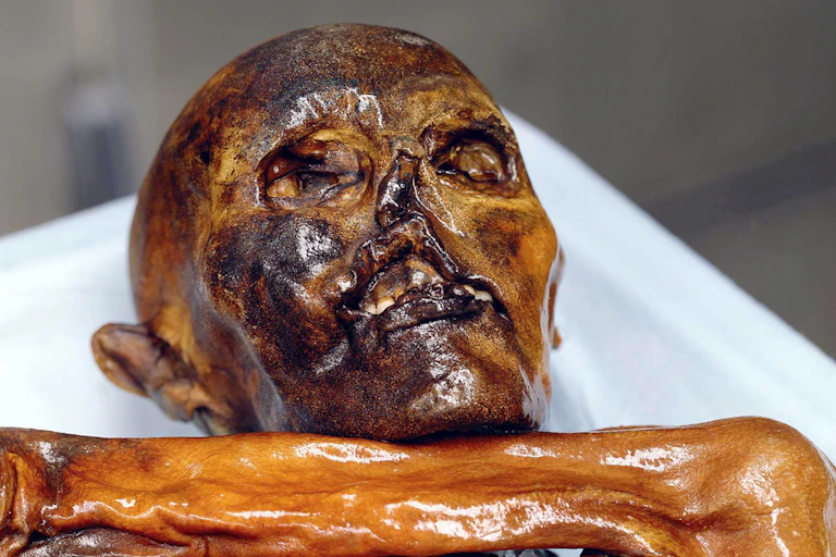Oetzi the iceman.