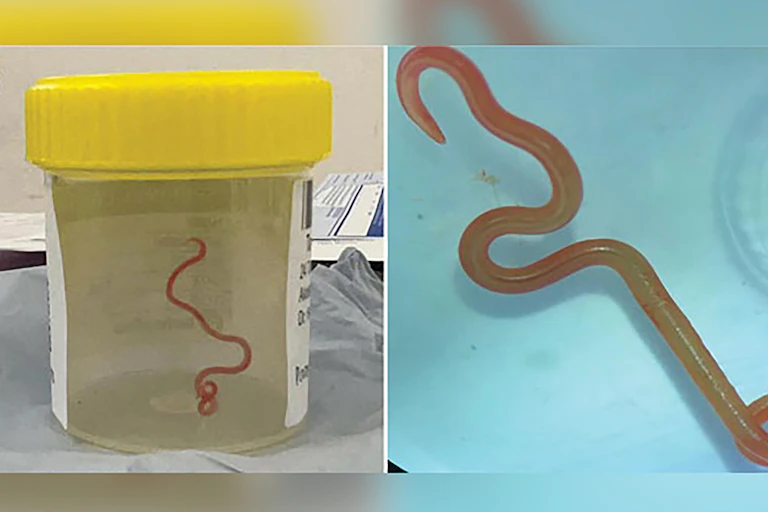specimen jar with worm inside
