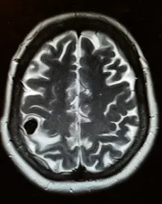 brain scan