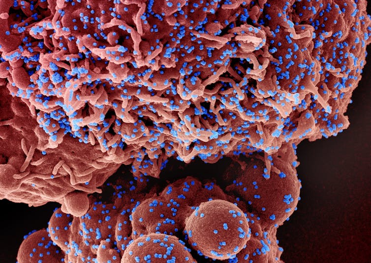 A reddish amorphous blob dotted with small blue particles