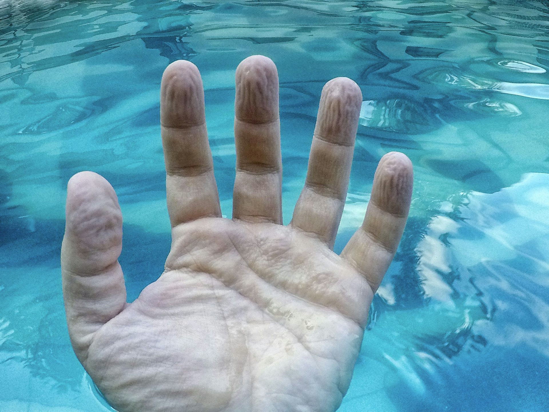 Mengapa jari tangan jadi keriput setelah mandi atau berenang cukup lama