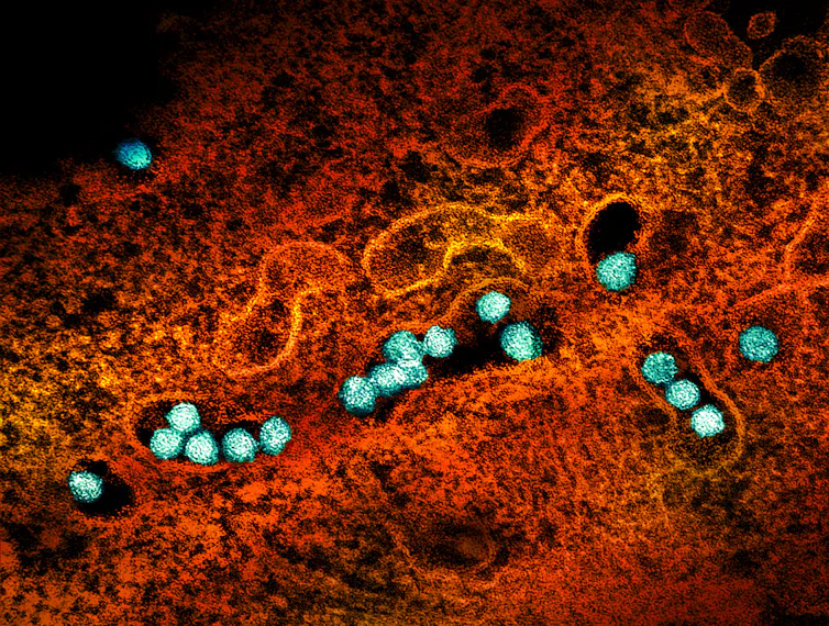 Round blue particles nestled in a red matrix