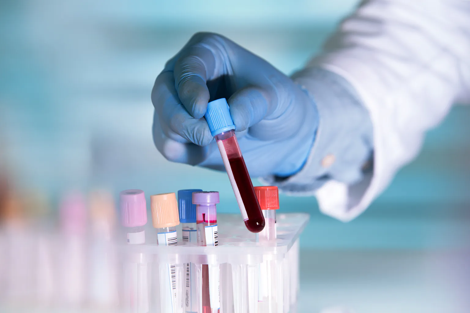 Alzheimer’s disease blood tests: here’s what they look for, and what ...