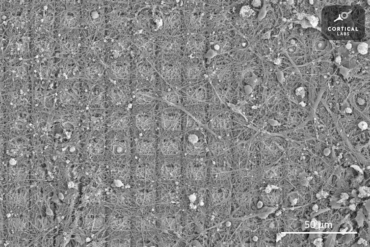 A microscope image shows a grid of squares covered with an irregular growth of strand-like neurons.