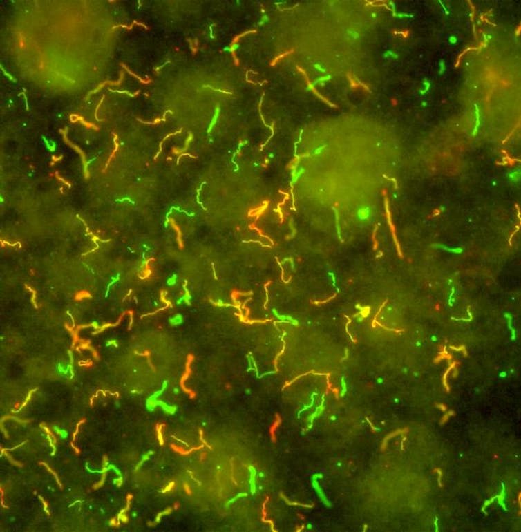 Bacteria that look like bright green and yellow squiggles against a dark green background