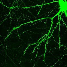 glowing green tendrils of a neuron against a black background