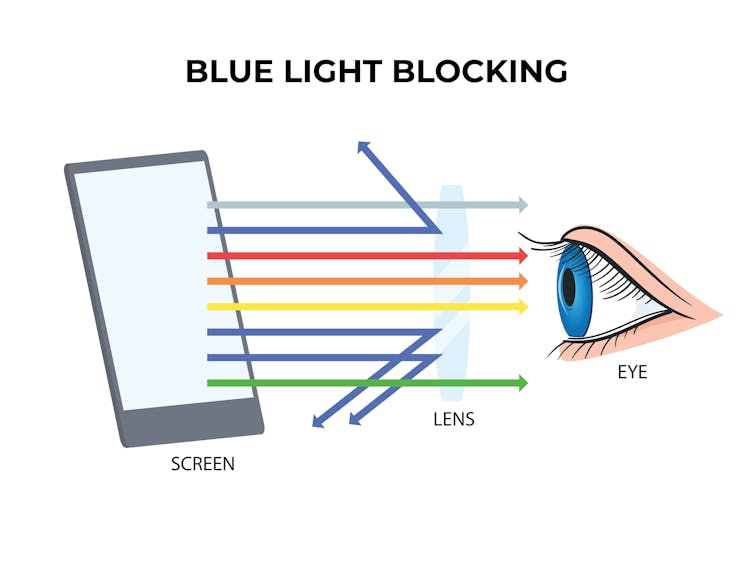 Blue light-filtering lenses block some blue light from screens from reaching the eye