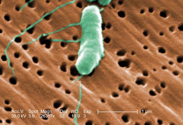 Microscopy image of Vibrio vulnificus 