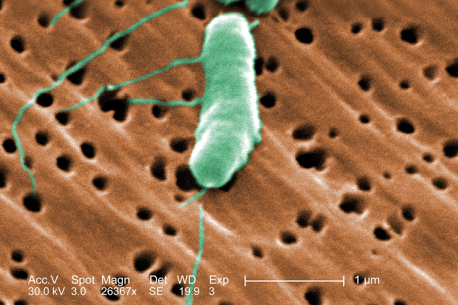 Flesh-eating bacteria infections are on the rise in the US − a microbiologist explains how to protect yourself