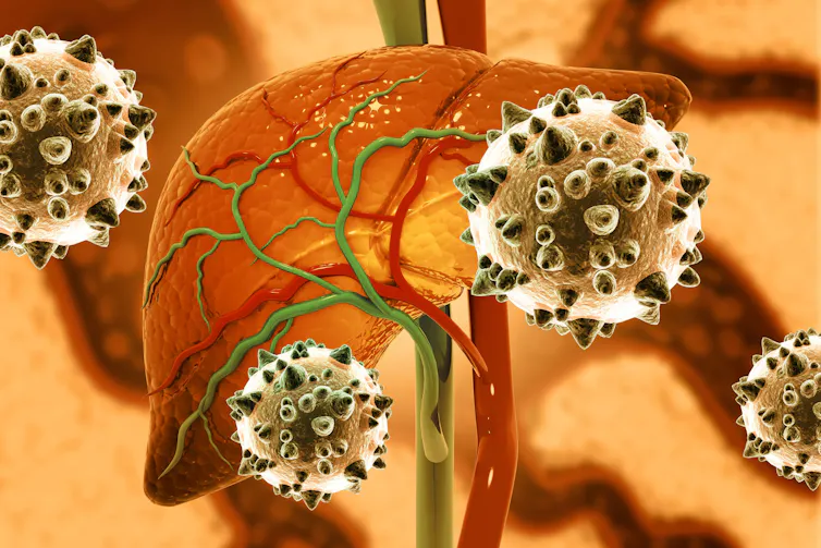 A digital drawing of a liver being attacked by hepatitis C viruses.