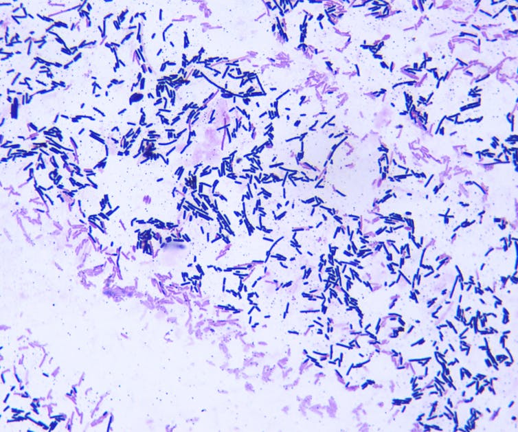 Microscopy image of Clostridium septicum
