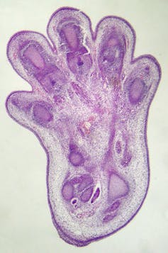 Microscopy image of mouse foot at embryonic stage