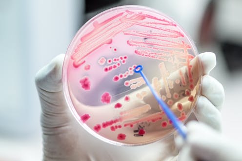 Will we still have antibiotics in 50 years? We asked 7 global experts
