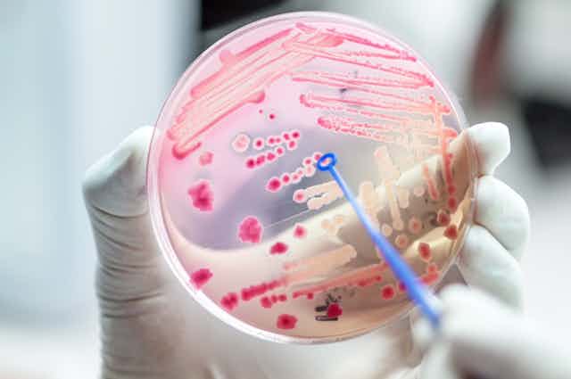 Bacteria growing on an agar plate