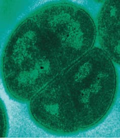 Transmission electron microscopy of an extremophilic bacterium