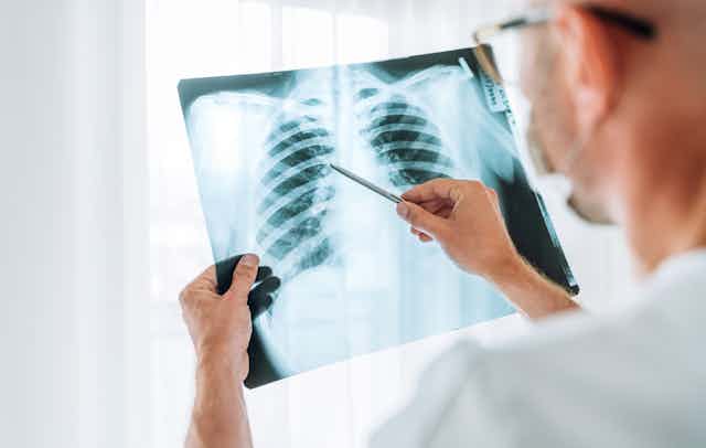 Doctor looks at chest X-ray