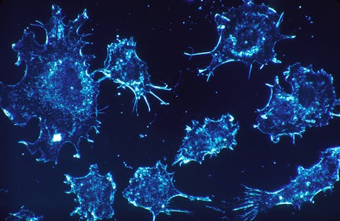 Cancer has many faces − 5 counterintuitive ways scientists are approaching cancer research to improve treatment and prevention