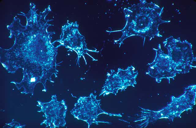 Microscopy image of cancer cells stained blue