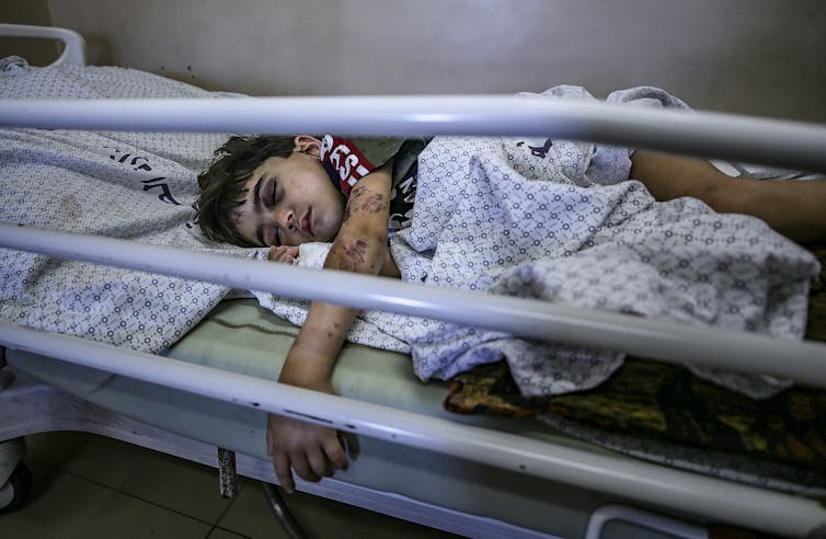 A young Palestinian girl lies in a  hospital bed in Gaza following airstrikes in 2021.