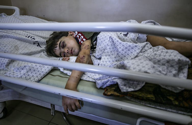 A young Palestinian girl lies in a hospital bed in Gaza following airstrikes in 2021.