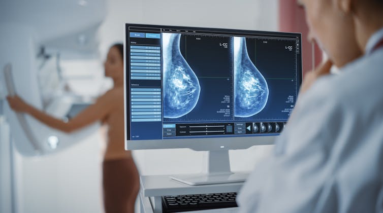 Mamografías periódicas y ejercicio físico, claves en el pronóstico del cáncer