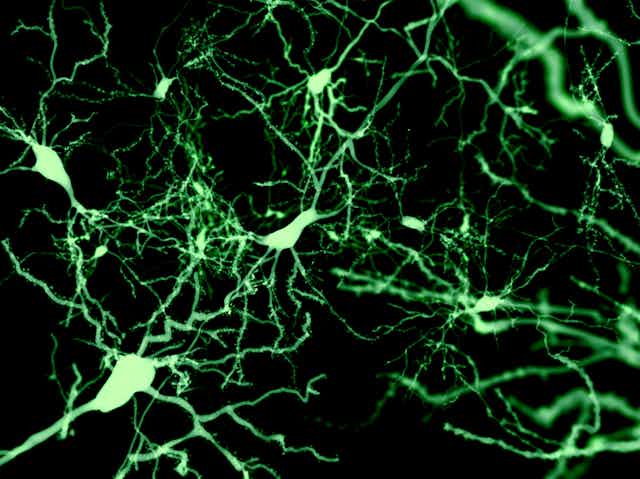 Neurons marked by fluorescence
