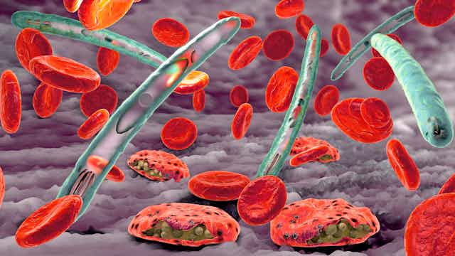 Une illustration montre des globules rouges et des formes du parasite responsable du paludisme