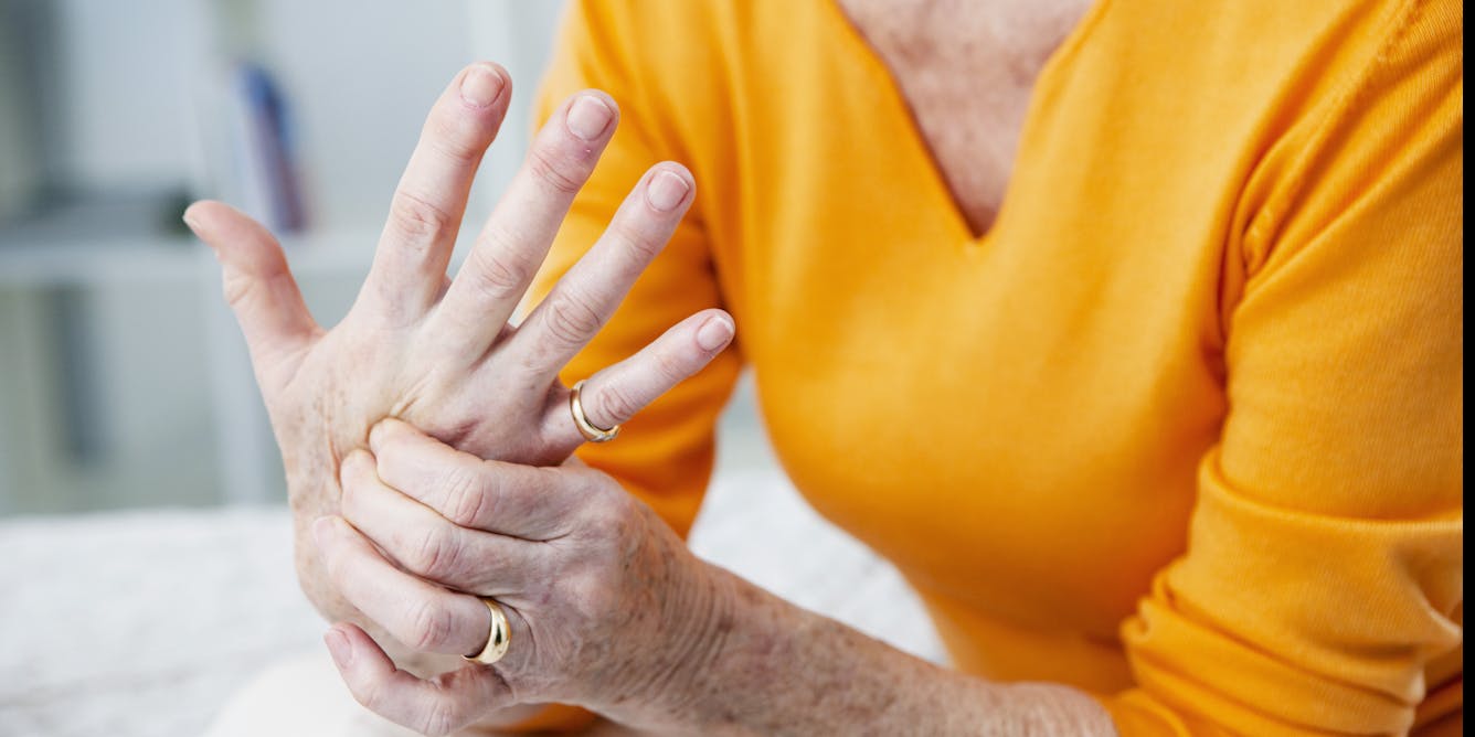 New research has found an existing drug could help many people with painful hand osteoarthritis - The Conversation