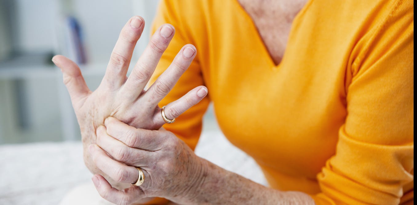 New research has found an existing drug could help many people with painful hand osteoarthritis  The Conversation New research has found an existing drug could help many people with painful hand osteoarthritis  The Conversation