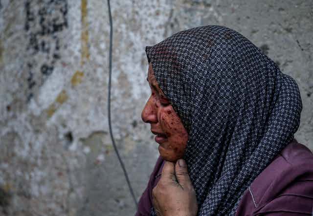 A woman in a headscarf with blood on her face against a graffitied wall