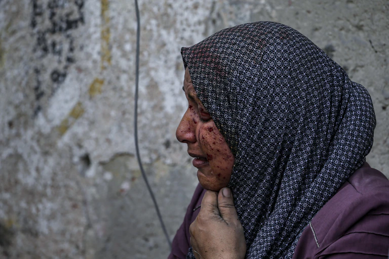 A woman in a headscarf with blood on her face against a graffitied wall