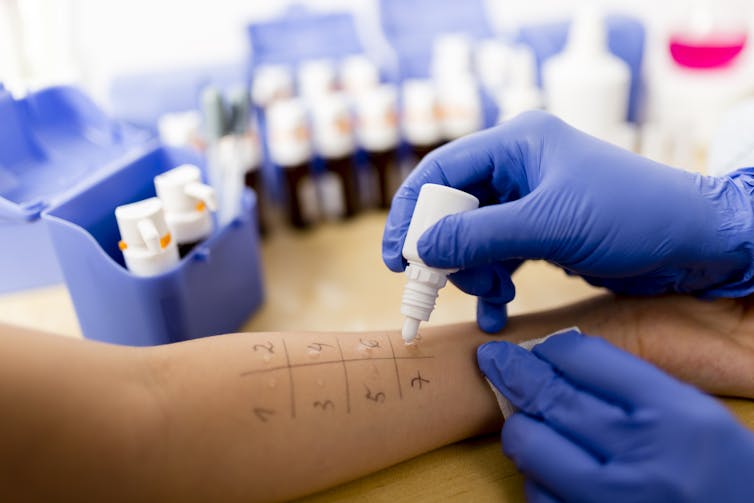 Allergist performs skin test on patient's arm